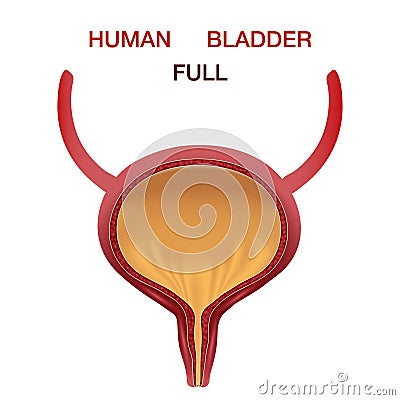 Full Urinary bladder. Human organ anatomy. Editable vector illustration in realistic style Vector Illustration