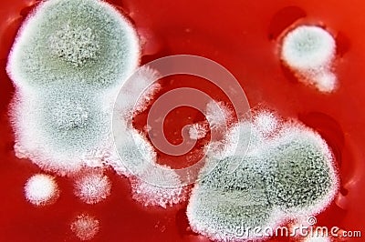 Fungal spores in the liquid. Viral bacterium in the blood.Fungal infection. Distribution and multiplication of fungi and Stock Photo