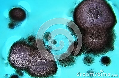 Fungal spores in the liquid. Viral bacterium in the blood.Fungal infection. Distribution and multiplication of fungi and Stock Photo