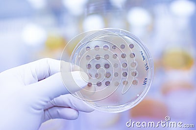 Fungi grown on agar plate. Stock Photo