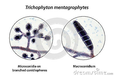 Fungi Trichophyton mentagrophytes, 3D illustration Cartoon Illustration