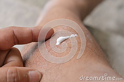 The fungus causes skin lesions Stock Photo