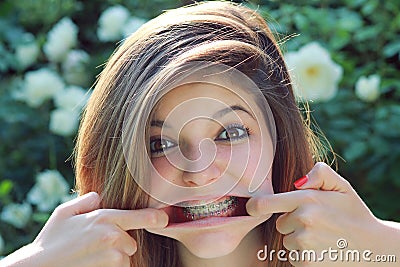 Funny expression with braces Stock Photo
