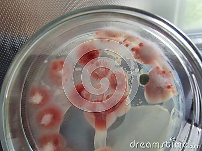 Fusarium fungal colonies on saboraud dextrose agar Stock Photo