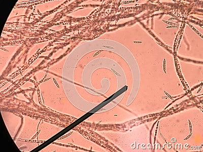 Fusarium sp. Pathogen of rice Stock Photo