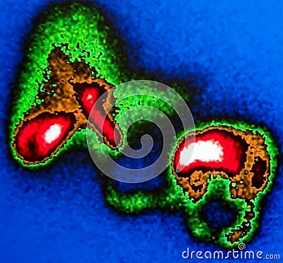 liver,gallbladder,intestine nuclear scan Stock Photo