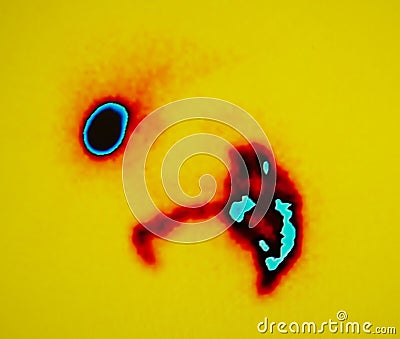 Gallbladder and intestine ,nuclear medicine Stock Photo