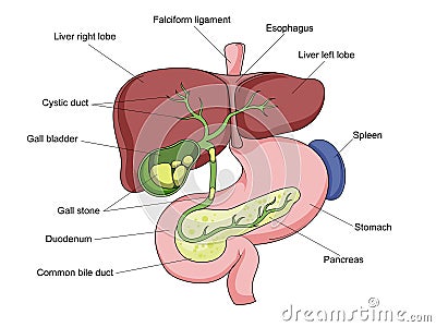 Gallstone stone gallbladder medical science Cartoon Illustration