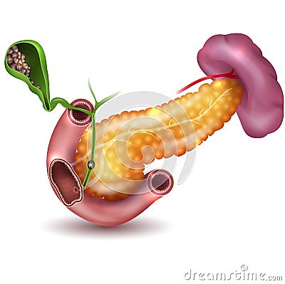 Gallstones Vector Illustration