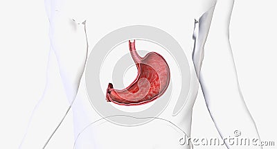 Gastritis is a condition in which the stomach lining known as the mucosa is inflamed Stock Photo