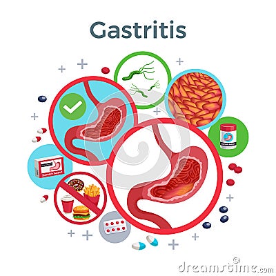 Gastritis Flat Composition Vector Illustration