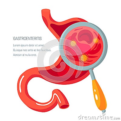 Gastroenteritis concept in flat style, vector icon Vector Illustration