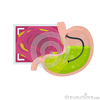 Gastroscopy. Endoscopy and digestive problems. Hose with camera Vector Illustration