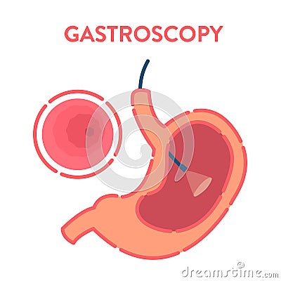 Gastroscopy procedure of stomach examination Vector Illustration