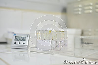 Gel colume agglutination in blood bank laboratory Stock Photo