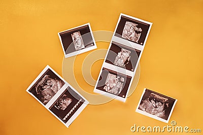 Gender-neutral names. Unisex nursery gender neutral. Calm nursery color palette games. Flat lay a snapshot of an ultrasound scan, Stock Photo