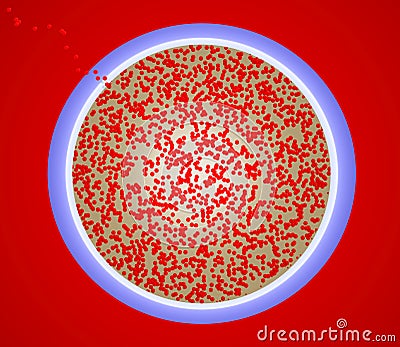 Germs Escaping From Petri Dish Stock Photo