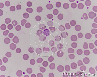 Giant platlet on red blood cells Stock Photo