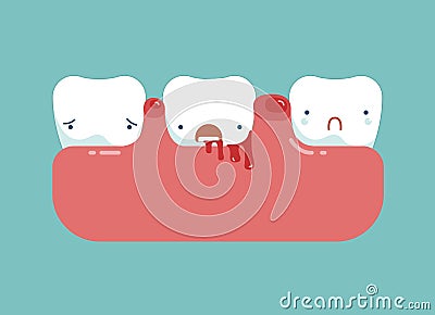 Gingivitis and blood ,dental concept Vector Illustration