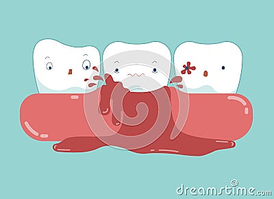 Gingivitis of dental and blood vector Vector Illustration