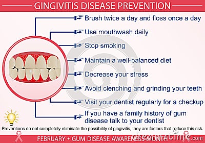 Gingivitis Disease Prevention Infographic Vector Illustration Vector Illustration