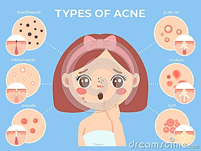 Girl with acne. Young unhappy female face with skin problems and pimple types icons. Dermatology and cosmetic skin care Vector Illustration