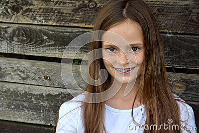 Girl with dental braces Stock Photo