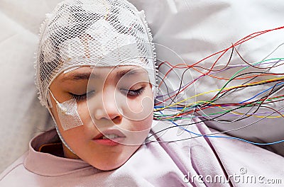 Girl with EEG electrodes attached to her head for medical test Stock Photo