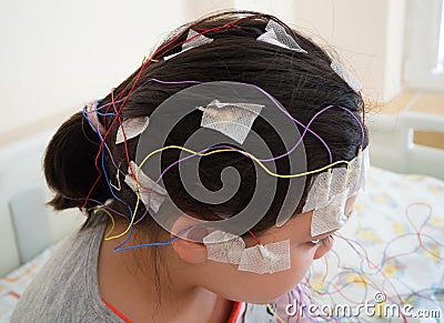 Girl with EEG electrodes attached to her head for medical test Stock Photo