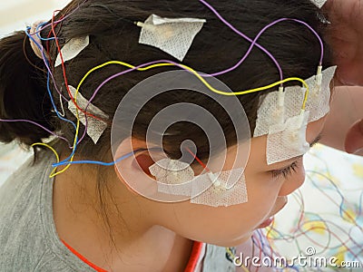 Girl with EEG electrodes attached to her head for medical test Stock Photo