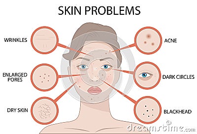 Girl Face with Skin problems, cosmetic care and beauty cosmetics medicine vector illustration Vector Illustration