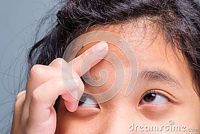 Girl has the pimples on skin for the first time Stock Photo