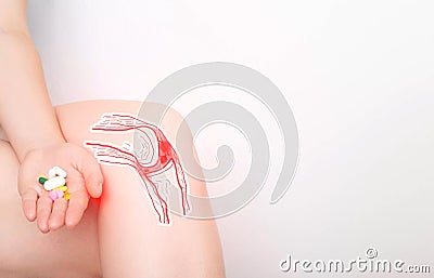 The girl holds a handful of pills in her hand for pain in the knee joint. Concept of drugs for the treatment and restoration of Stock Photo