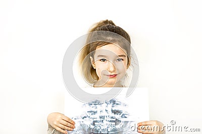 Girl holds her X-ray with a panorama of baby teeth and the second row of replaceable molars. Two rows of teeth, change to Stock Photo