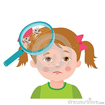Girl with lice. Magnifying glass close up of a head. Vector illustration. Dirty head. Dirty hair. Infection. Vector Illustration