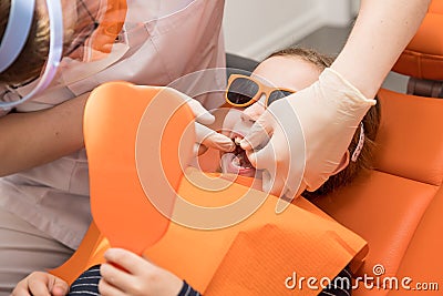 girl opened her mouth to check with a dentist, monitor teeth health.Children tooth care and hygiene Stock Photo