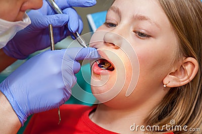 Girl on a reception for stomatology Stock Photo