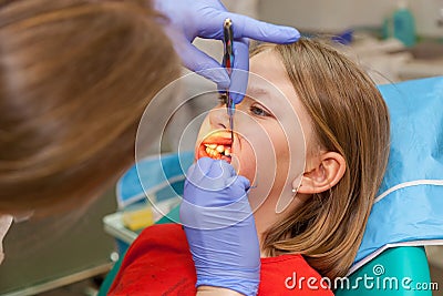 Girl on a reception for stomatology Stock Photo