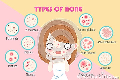 Girl with types of acne Vector Illustration