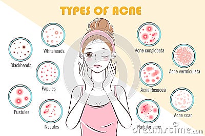 Girl with types of acne Vector Illustration