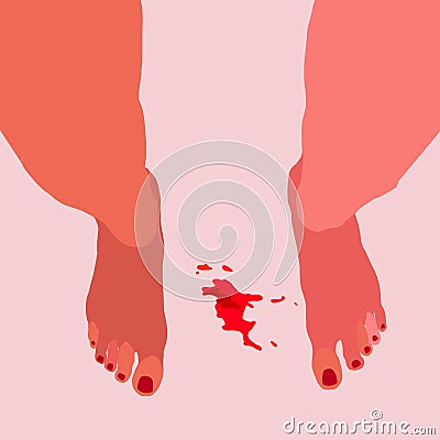 Girl's legs, bloodstain. Menstruation theme, period. Feminine hygiene. Vector Illustration