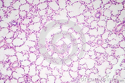 Glandular epithelium, micrograph Stock Photo