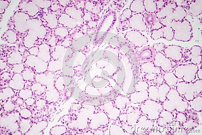 Glandular epithelium, micrograph Stock Photo