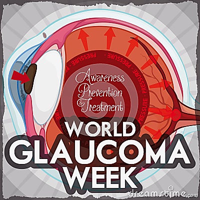 Glaucoma Week Design with Eye Affected for High Intraocular Pressure, Vector Illustration Vector Illustration