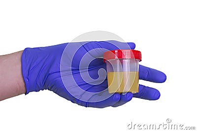 A gloved doctor hand with the urine container for medical urine test. A photo of urine specimen, medical analysis in the laborator Stock Photo