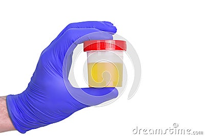 A gloved doctor hand with the urine container for medical urine test. A photo of urine specimen, medical analysis in the laborator Stock Photo