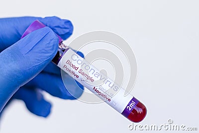 A gloved doctor holding a positive blood test result for coronavirus in Turkey Stock Photo