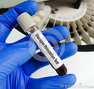 Glucagon Stimulation Test, Hypoglycemia Stock Photo