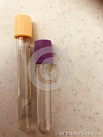 Gold and lavender top blood sample vacuum tubes. Stock Photo