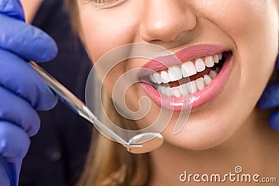 Gorgeous healthy smile with dentist mirror Stock Photo